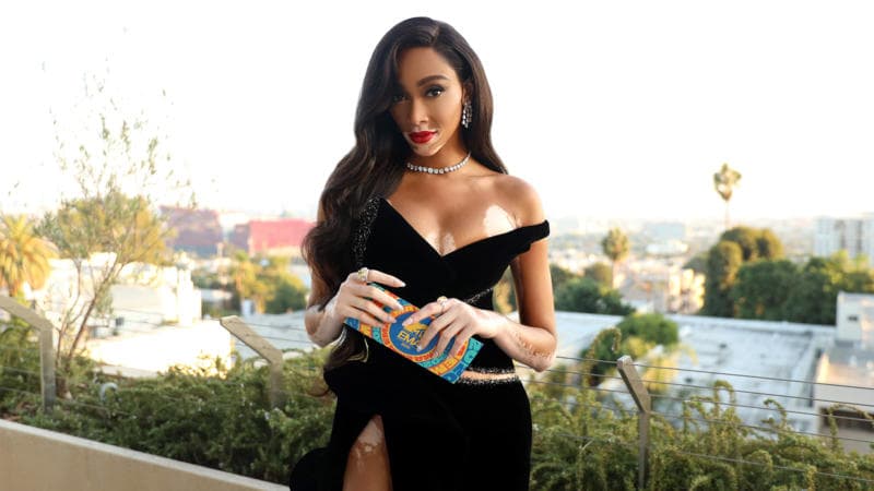 Winnie Harlow Joins Few Black Female Founders Who've Raised Over $1M In Funding After $4.1M Seed Round For Her Skincare Line