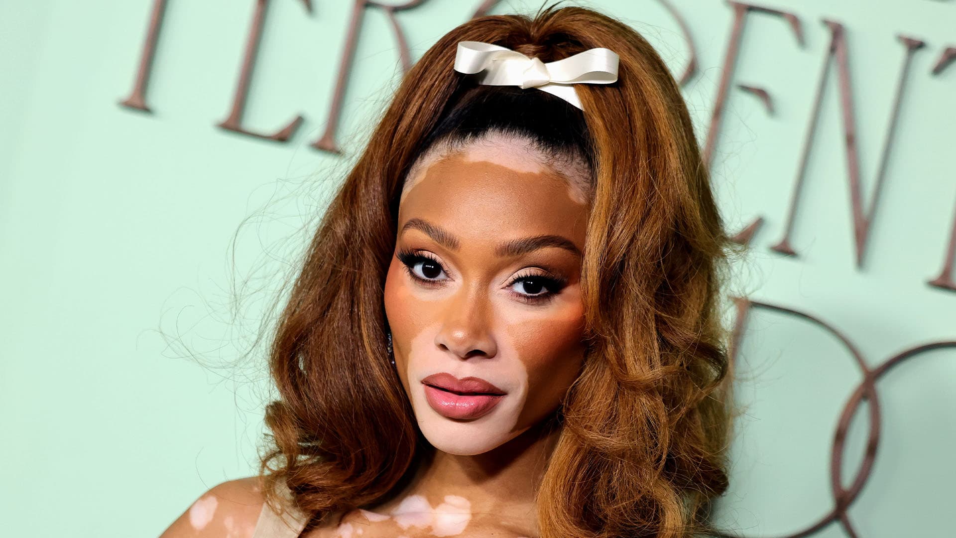Winnie Harlow Reflects On Raising More Than $6M For Her SPF Skincare Brand Cay Skin — 'When It Came To Even Fundraising, I Still Got A Lot Of No's' Winnie Harlow Reflects On Raising More Than $6M For Her SPF Skincare Brand Cay Skin — 'When It Came To Even Fundraising, I Still Got A Lot Of No's'